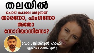 തലയിൽ പൊടി പോലെ വരുന്നത് താരനോ ഫംഗസോ അതോ സോറിയാസിസോ Psoriasis decoded episode 7 DrBishurul Hafi [upl. by Roddie]