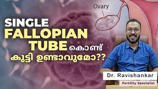 Single fallopian tube കൊണ്ട് കുട്ടികൾ ഉണ്ടാകാൻ സാധ്യതയുണ്ടോ baby pregnancy [upl. by Anatolio]