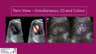 Image Optimization for the Seasoned Sonographer  Janie Huber  Advanced Fetal Imaging Conference [upl. by Derreg816]