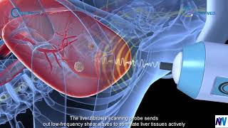 Fibrotouch India FT 100  Liver Scan  NAFLD Prevention  NW Overseas  India [upl. by Ykciv852]