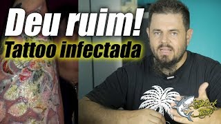 Tatuagem infeccionada [upl. by Attehcnoc329]