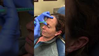 Quick Dysport Treatment at YPS dysport botox injection [upl. by Lrigybab77]