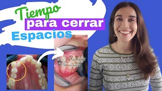 ¿Cuánto tiempo se tarda en CERRAR ESPACIOS en ortodoncia después de una extracción dental [upl. by Norre]