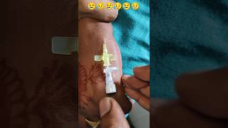 181 IV Cannulation Technique  Cannula Lagana Sikhe cannula shortfeed viralreel trend videos [upl. by Neryt]