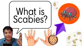 What is Scabies Is it Fungal Virus Bacteria or Parasite Nursing Review  NP1 [upl. by Ardet]