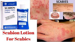 Scabion Lotion uses In Urdu [upl. by Airdnassac292]