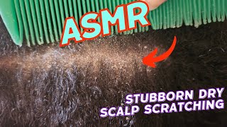 ASMR  FLAKY DRY SCALP SCRATCHING  VERY SATISFYING 😌 [upl. by Ronoh602]