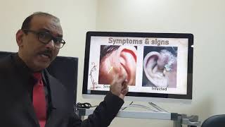 Preauricular sinus Urdu Patient teaching programme [upl. by Amersham]