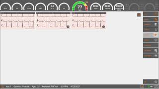 การใช้งาน Cardioline EST Cube Stress  Report [upl. by Aivital]