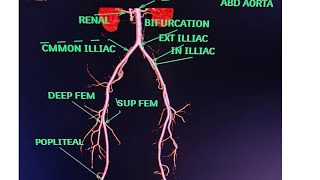 CT Lower Limb Angiography Anatomy CT scanPost processing avnishradiologypart1 [upl. by Oza]