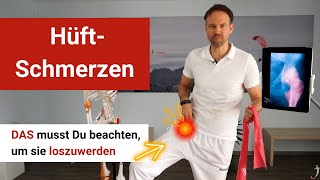 Hüftschmerzen ⚡ Warum sie nichts mit Deinem Hüftgelenk zu tun haben und viele Behandlungen scheitern [upl. by Gore]