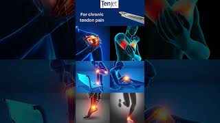 TenJet  a minimally invasive treatment option for chronic tendon pain [upl. by Odlanor626]