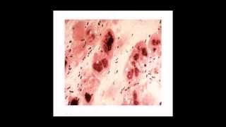 Clase virtual de Streptococcus [upl. by Egedan]