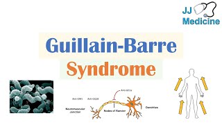 GuillainBarré Syndrome GBS  Causes Pathophysiology Signs amp Symptoms Diagnosis Treatment [upl. by Keever701]