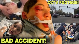 FOOTAGE of Nidal Wonder SCOOTER CRASH ACCIDENT 😱😳 TERRIBLE CAR ACCIDENT EXPLAINED [upl. by Sauncho]