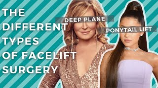 Facelift 101 Ponytail Lift vs Deep Plane Facelift vs Mini Lift [upl. by Annaik]