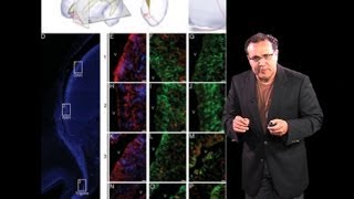 Alfredo QuiñonesHinojosa Johns Hopkins Part 2 Stem Cells and Brain Tumors [upl. by Nickerson]