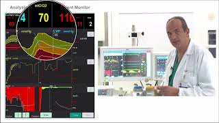 What are the hemodynamics effect of acute hypercapnia and acute hypoxia [upl. by Landmeier]