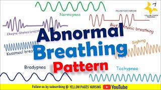 ABNORMAL BREATHING PATTERN  Apnea  Bradypnea  Tachypnea  Ataxic  Sighing  CheyneStokes [upl. by Blanka473]