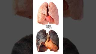 2 MEASURABLE Ways Smoking DESTROYS the Lungs  Doctor Explains [upl. by Attelocin]