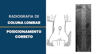 Qual o melhor posicionamento para RaioX de Coluna Lombar  RaioX Veterinário [upl. by Aisyla]