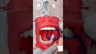 Afastador de língua e bochecha dentist odontologia tips [upl. by Tlihcox911]