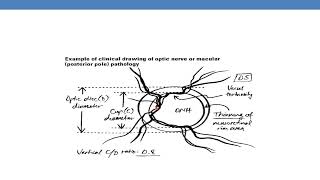 CPT CODING GUIDELINES FOR MEDICINE PART 7 Ophthalmology [upl. by Kramlich]