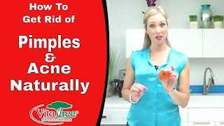 Rosacea  How to Get Rid of Pimples Naturally  VitaLife Show Ep 160 [upl. by Ivana]