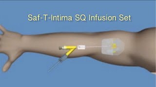 How to Insert SafTIntima™ SQ Infusion Set [upl. by Lynd]