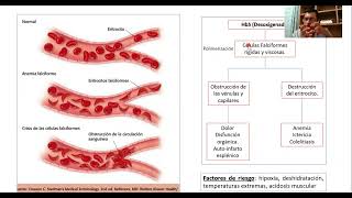 ANEMIA DE CÉLULAS FALCIFORME Parte 1 [upl. by Yukio181]