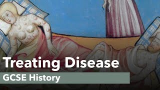 Treating Disease  GCSE History [upl. by Eimarrej]