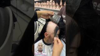 Alopecia girl use hair patch in salon 😱🥰 [upl. by Nilrem676]