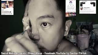 Ellowe Alviso  7th Day Ng Paglilinis ko Ng Sugat Sa Aking Ilong  Skin Grafting forhead [upl. by Esiuole]