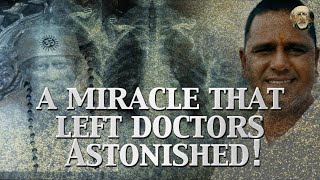 A Miracle That Left Doctors Astonished [upl. by Auqinihs568]