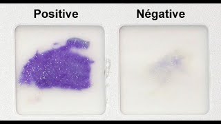 Oxidase Test Practical Tutorial [upl. by Strong]