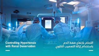 Controlling Hypertension with Renal Denervation [upl. by Ahsienat]