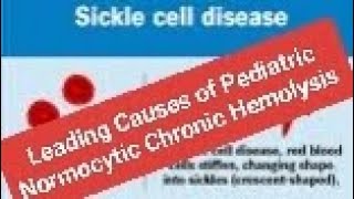 Leading Causes of Pediatric Normocytic Chronic Hemolysis SCD [upl. by Ived]