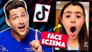 Shocking Medical Conditions On TikTok [upl. by Zephaniah188]