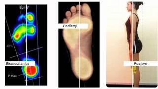 freeStep foot amp posture evaluation software [upl. by Grote]