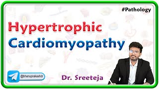 9 Hypertrophic Cardiomyopathy Pathology USMLE Step 1 [upl. by Nwahsel]