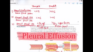 Pleural Effusion  Transudate Vs Exudate Respiratory 47  First Aid USMLE Step 1 in UrduHindi [upl. by Hahcim]