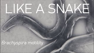 Snake like motion on a tiny scale  Brachyspira [upl. by Naie]