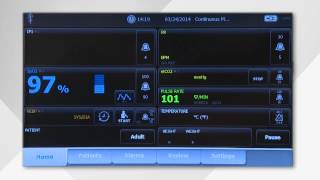 Welch Allyn Connex Vital Signs Monitor User Guide [upl. by Hsan]