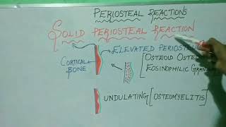 PERIOSTEAL BONE REACTIONS [upl. by Gabriel]