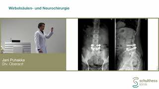 «Fallauflösung  Hausarztfortbildung Wirbelsäule»  Schulthess Klinik [upl. by Leinoto]