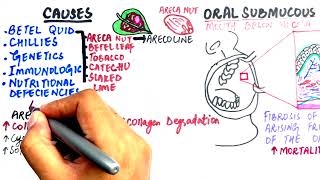 Oral Submucous Fibrosis  Causes Histopathology Epidemiology amp Treatment [upl. by Roselin]