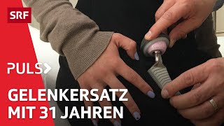 Arthrose Was hilft gegen den schmerzhaften Knorpelabbau in Knie und Hüfte  Puls  SRF Wissen [upl. by Aires]