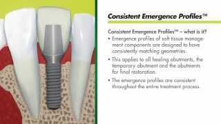 Straumann Bone Level Implants  Consistent Emergence Profiles [upl. by Eliezer]