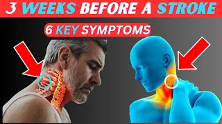 6 Top Stroke Symptoms 3 Weeks before it happens [upl. by Anafetse]