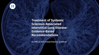 New Clinical Practice on Treatment of SclerosisAssociated Interstitial Lung Disease [upl. by Eirovi]